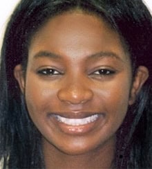 A smiling woman with braided hair with crossbite