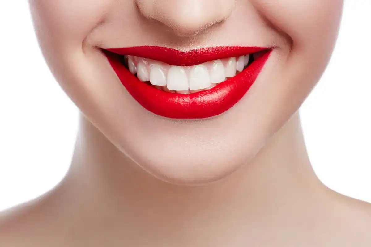 A bright, smiling woman showcasing healthy, white teeth and vibrant red lipstick.