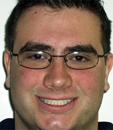 A smiling man with glasses without crowding issues