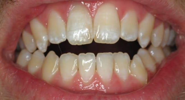 A healthy, natural smile showing clean, well-aligned teeth and gums.