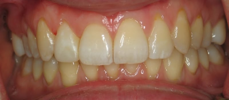 A healthy smile with clean, well-aligned teeth