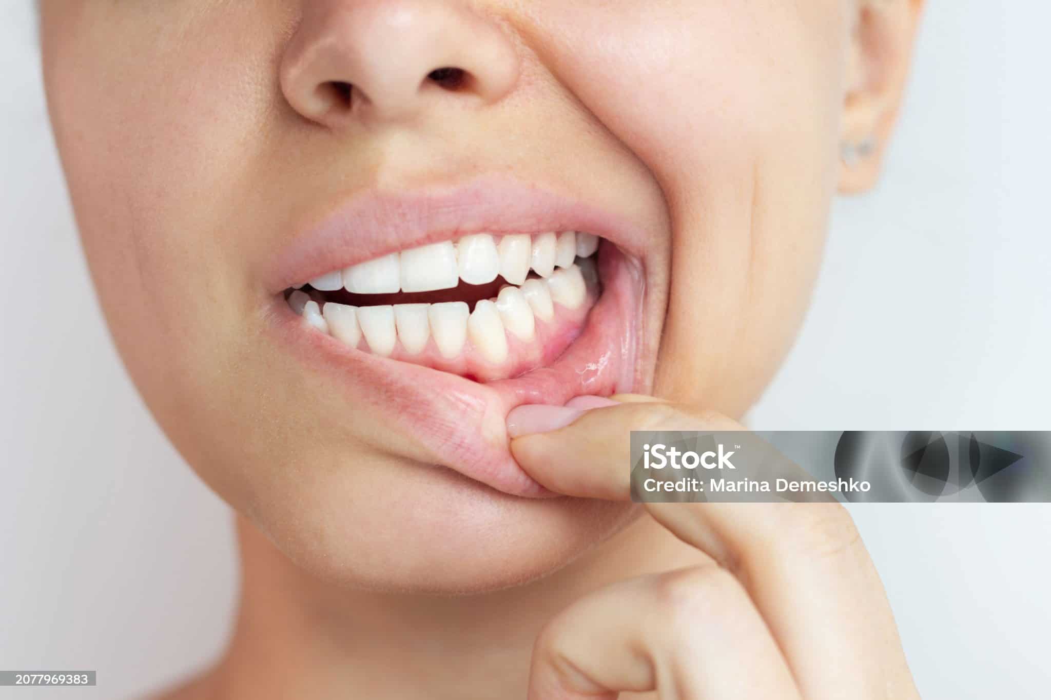 A woman touching her lips, close-up of dental health and oral hygiene.