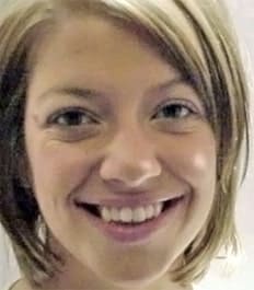 A smiling woman with open bite