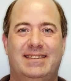 A smiling man with crowding and crossbite