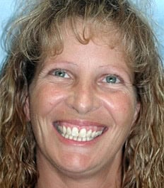 A smiling woman with blonde curly hair showing her healthy teeth